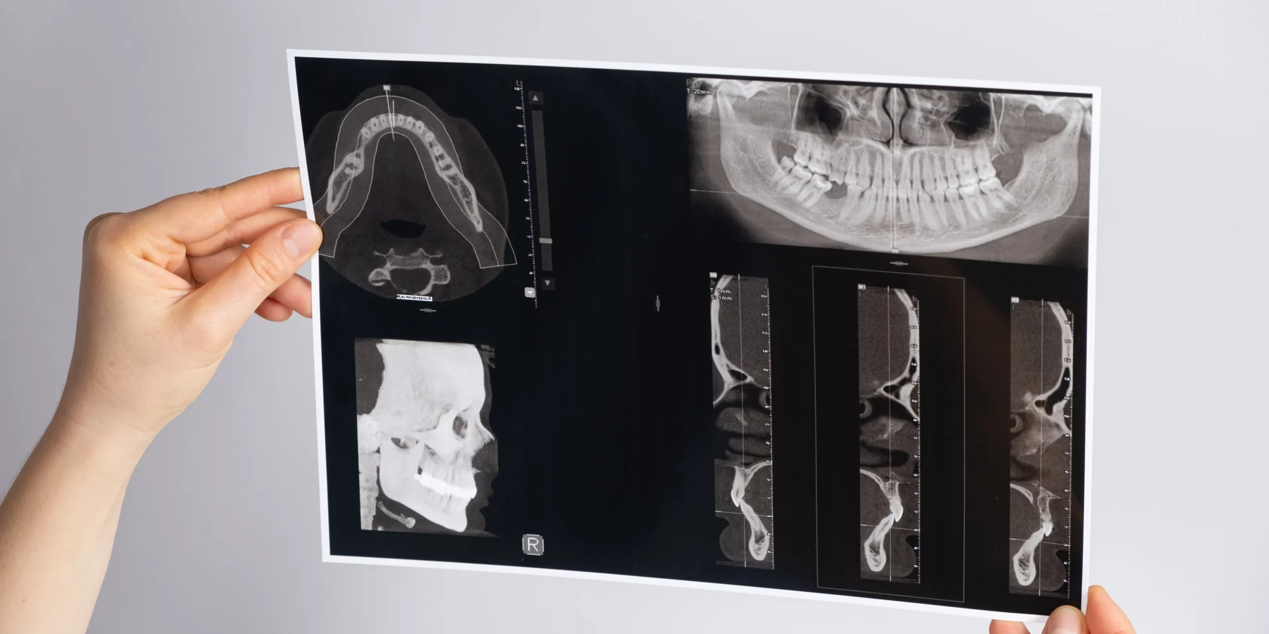 Malocclusione: cause, sintomi e cure per un sorriso perfetto | Centro Politerapico Polidiagnostico Monza